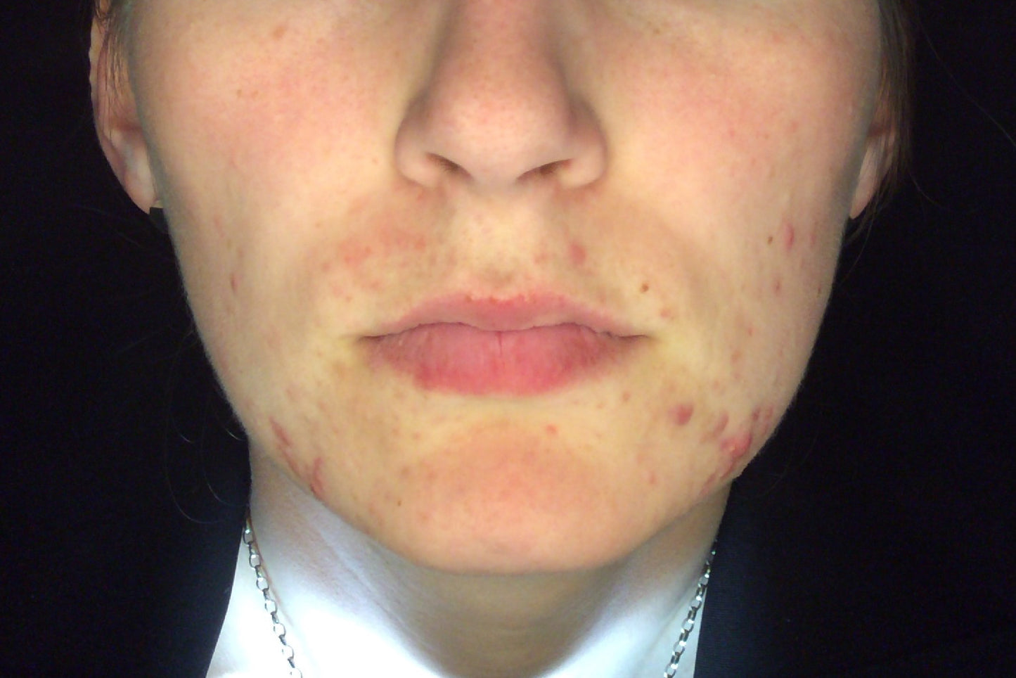 CASE STUDY: Observe Analysis