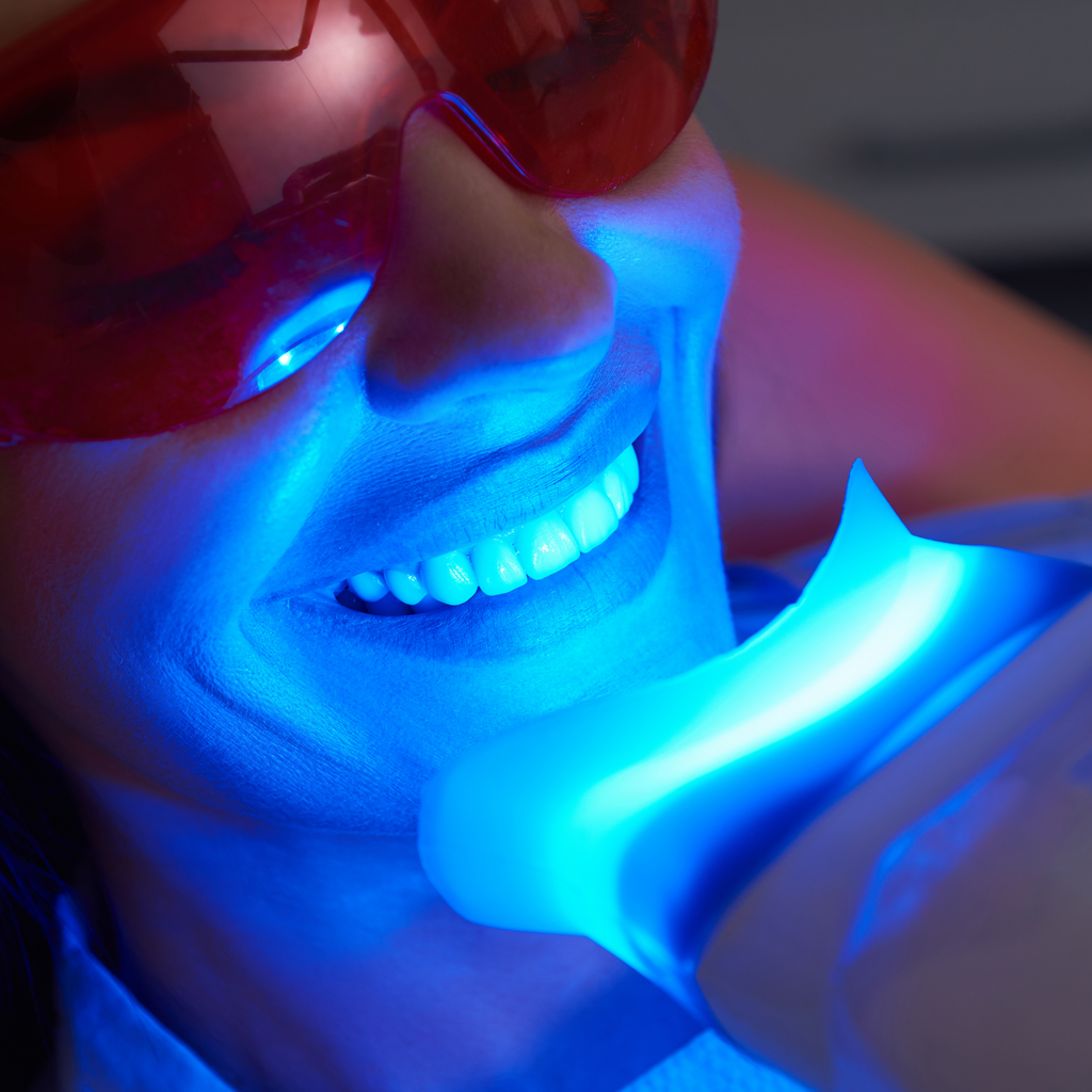 Pros and Cons of Teeth Whitening Procedures